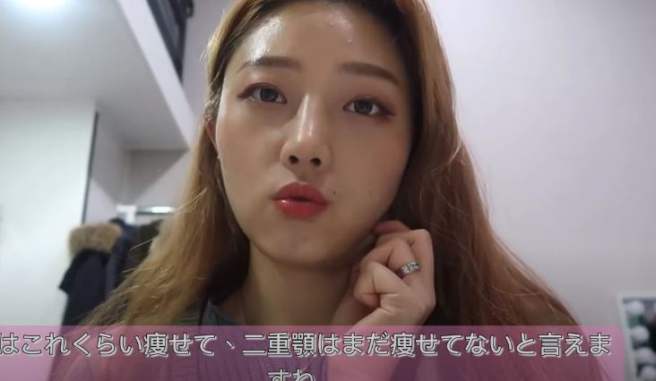 韓国整形vlog 二重アゴ脂肪吸引後のダウンタイムお見せします